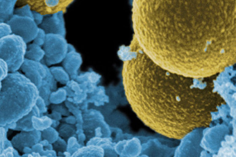 Staphylococcus aureau