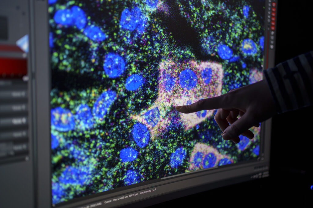 someone pointing to a screen with blue, green, and peach shapes